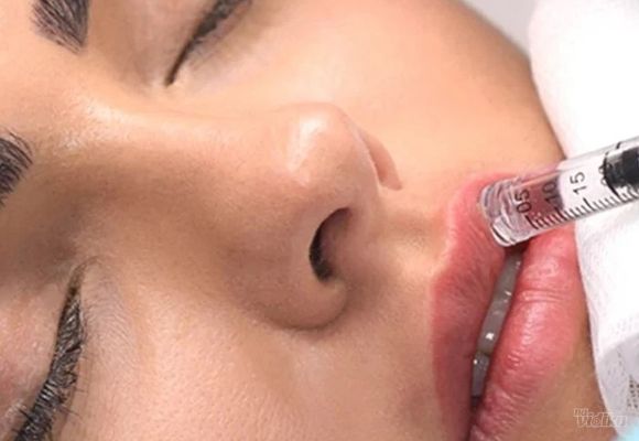 Hijaluron pen 1ml