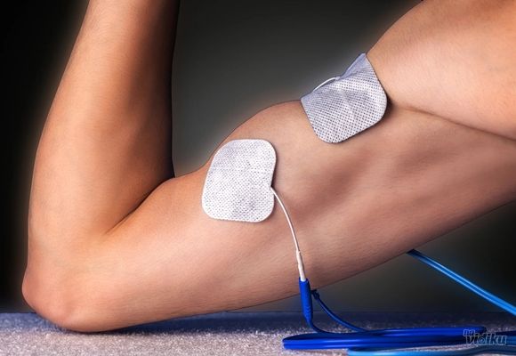 Elektrostimulacija mišića 1 tretman