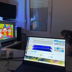 Neurofeedback + logopedski čas