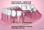 Bredent implanti