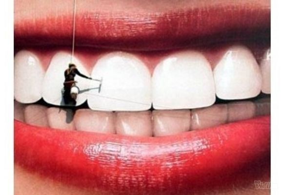 Uklanjanje zubnog kamenca + peskiranje zuba (Air flow)
