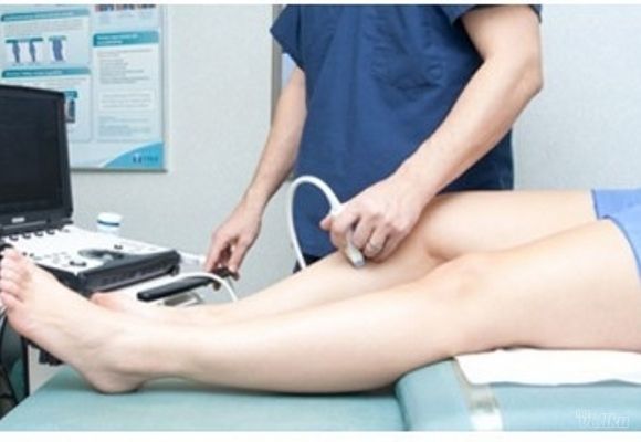 COLOR DOPLER krvnih sudova nogu sa pregledom vaskularnog hirurga