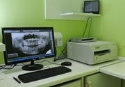 Snimanje zuba - digitalni ortopan