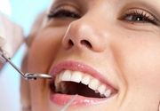 Čišćenje - poliranje zuba (skidanje kamenca, peskiranje, fluorizacija)