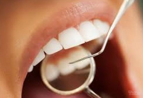 Čišćenje zubnog kamenca, peskiranje i poliranje svih zuba
