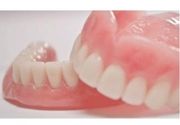 Izrada zubnih proteza