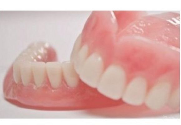 Izrada zubnih proteza