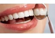 Uklanjanje mekih naslaga sa poliranjem zuba
