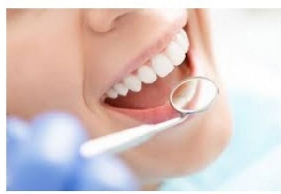 Plombiranje zuba - jednopovršinska (bela) plomba sa poliranjem zuba