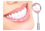 Plombiranje zuba - tropovršinska (bela) plomba sa poliranjem zuba