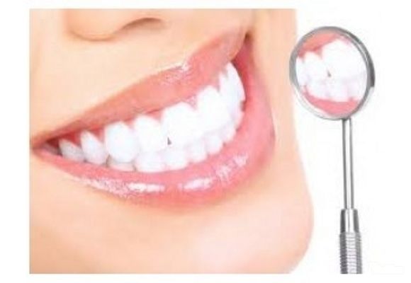 Plombiranje zuba - tropovršinska (bela) plomba sa poliranjem zuba
