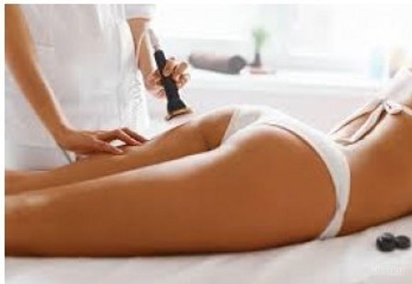 Paket od 5 tretmana ultrazvučne kavitacije u trajanju od 40min