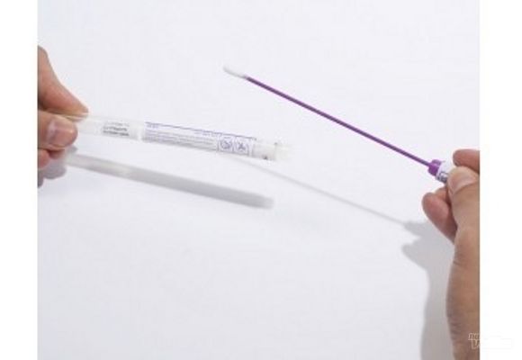 PREMIUM PAKET PLUS analiza i briseva za dame ili muškarce sa rezultatima (cervikalni + vaginalni bris sa antibiogramom/uretralni, chlamydia, mycoplazma, ureaplazma, kandida, trimnhomonas, gonokok)