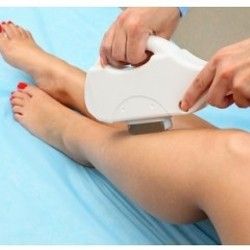Super cena! Laserska epilacija SHR tehnologijom noge + prepone