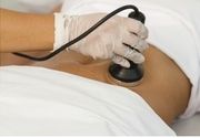 Tretman ultrazvučne kavitacije sa limfnom drenažom
