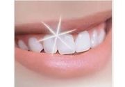 Lasersko izbeljivanje zuba (obe vilice)