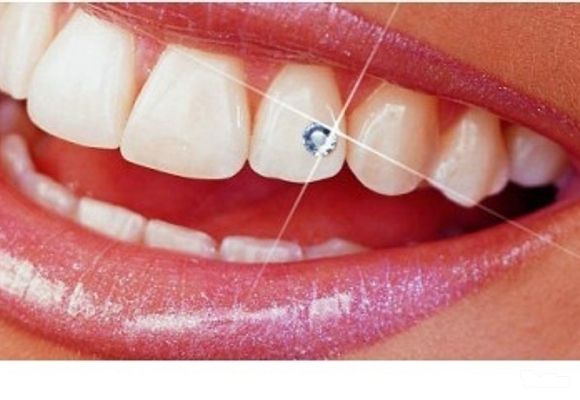 Zubni nakit (cirkon)