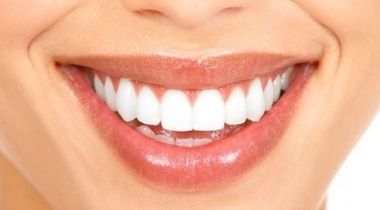 Kućno beljenje zuba (2 folije + 4 šprica)
