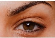 Estetska korekcija gornjih očnih kapaka