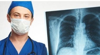 Rendgen pluća sa opisom radiologa