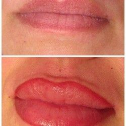 Trajna Šminka Usana - Kozmeticki salon Womanizer