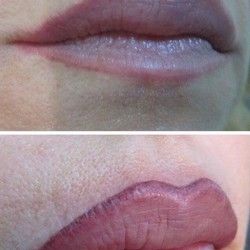 Trajna Šminka Usana 3 - Kozmeticki salon Womanizer