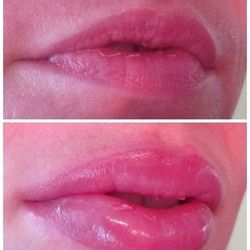 Trajna Šminka Usana 4 - Kozmeticki salon Womanizer