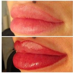 Trajna Šminka Usana 5 - Kozmeticki salon Womanizer