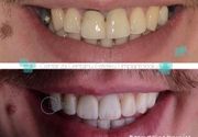 Krunice 5 - Centar za dentalnu estetiku i implantologiju