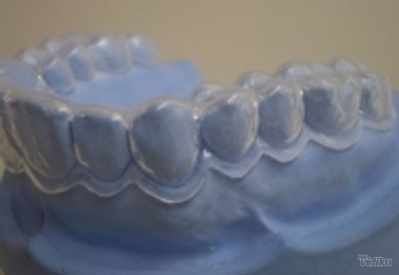 Izbeljivanje zuba Klijent 36