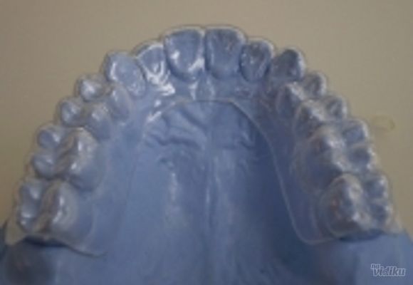 Izbeljivanje zuba Klijent 39