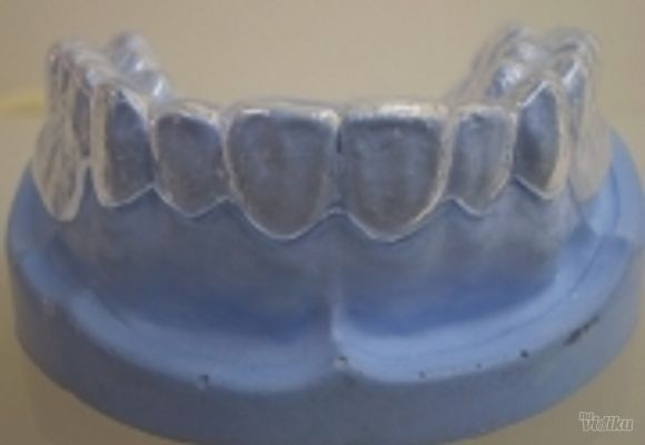 Izbeljivanje zuba Klijent 40