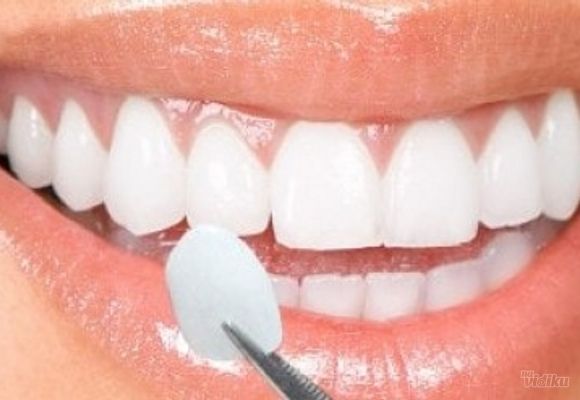 Izbeljivanje zuba Klijent 49