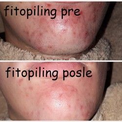 Fitopiling
