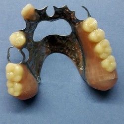 Popravka zubne proteze