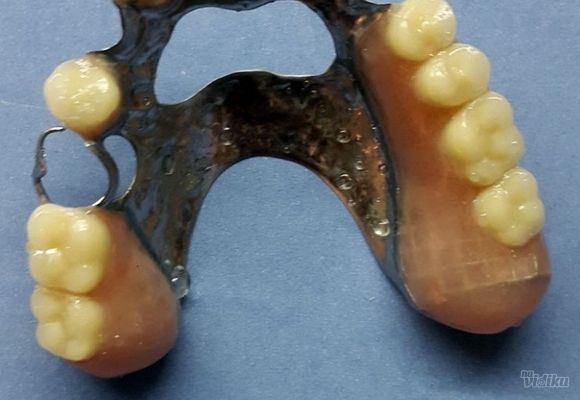Popravka zubne proteze
