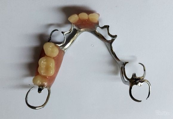 Popravka zubnih proteza