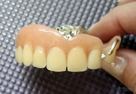 Reparatura zubne proteze