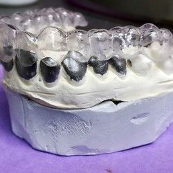 Izrada splinta za zube