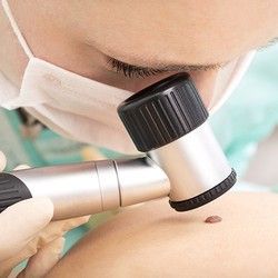 Dermoskopski pregled kože i mladeža