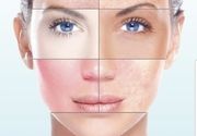 3 dermatološki razvijene metode