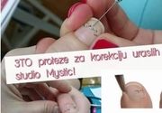 Medicinski pedikir i proteze za urasle nokte