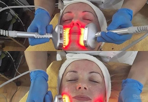 Tretman lica Bio electricity aparatom u Hipnotic Beauty & Massage centru
