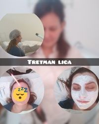 Tretman lica