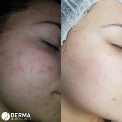 Stručna dermatološko-kozmetološka pomoć