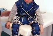 Lecenje cerebralne paralize kod dece