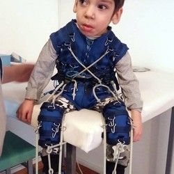 Lecenje cerebralne paralize kod dece