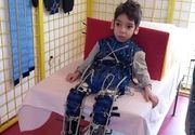 Najnovije metode za lecenje cerebralne paralize