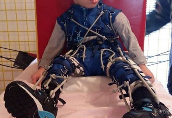 Savremene metode lecenja cerebralne paralize