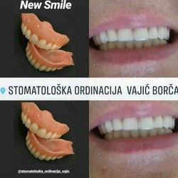 Totalne proteze/ Borca Beograd